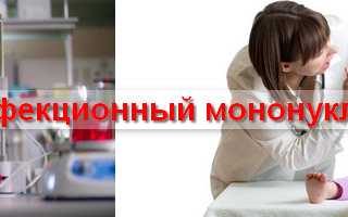 Инфекционный мононуклеоз: как лечить, причины и прогноз