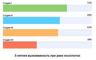 Лечение рака носоглотки в Израиле