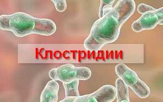 Что такое клостридии, лечение и профилактика заболевания