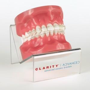 Чем хороши брекеты Clarity и как они выглядят