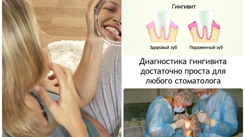 Что такое коагуляция десны