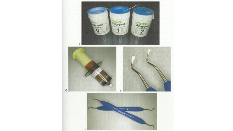 Что такое ретракция десны