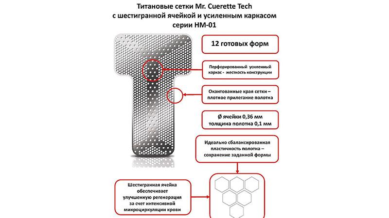 Для чего применяются титановые сетки в стоматологии