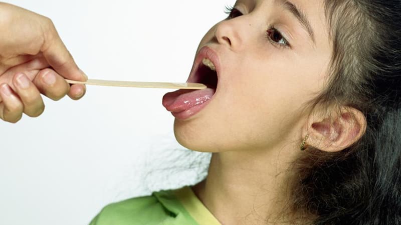 Галитоз и различные заболевания