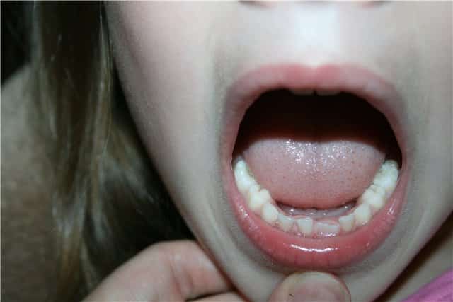 Проверяем все ли зубки на месте Проверяем все ли зубки на месте