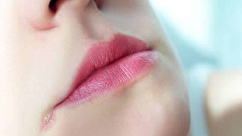 ангулярный стоматит фото