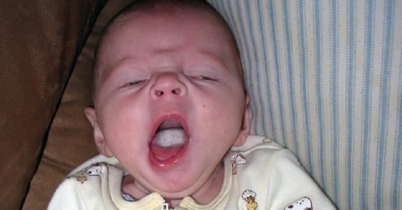 красное бело пятно на языке у ребенка пятнышко