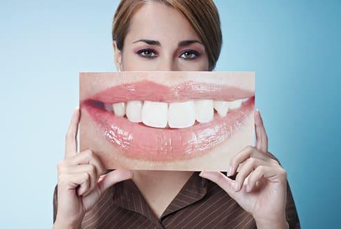 Белоснежная улыбка Белоснежная улыбка