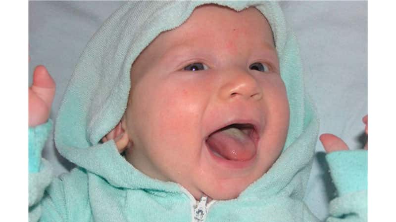 Причины появления налета на языке