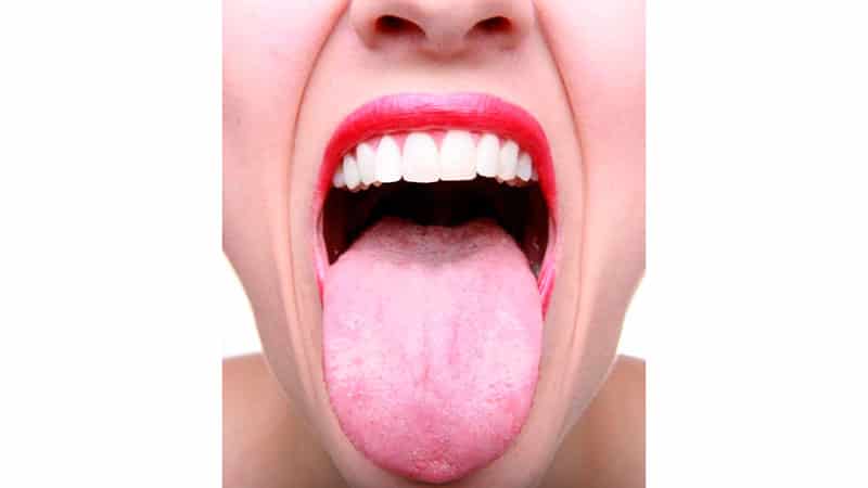 Белый налет на языке у взрослого