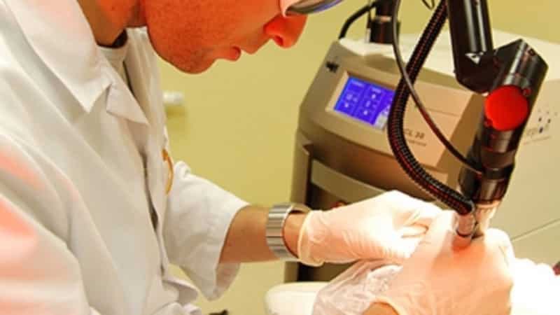 под языком нарост фото