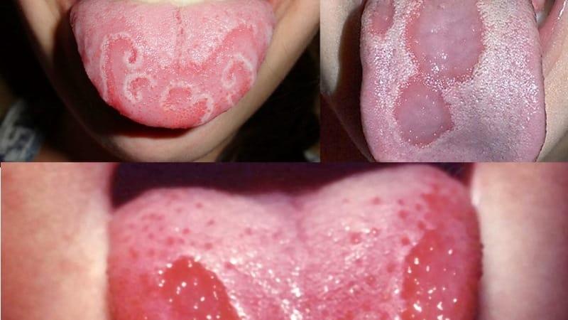 болезни языка к какому врачу обращаться