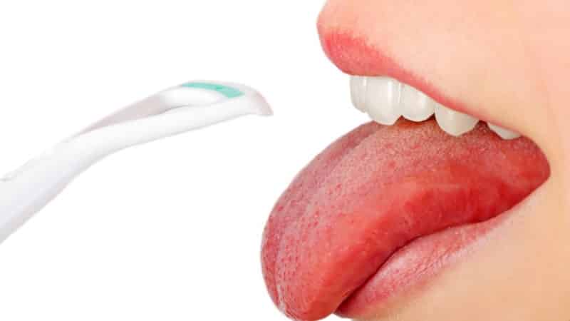 болезни языка человека лечение