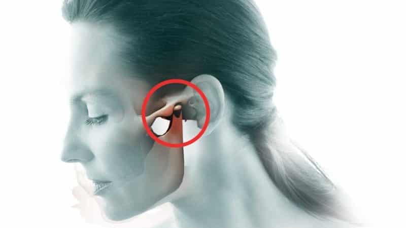 болит челюстной сустав лечение