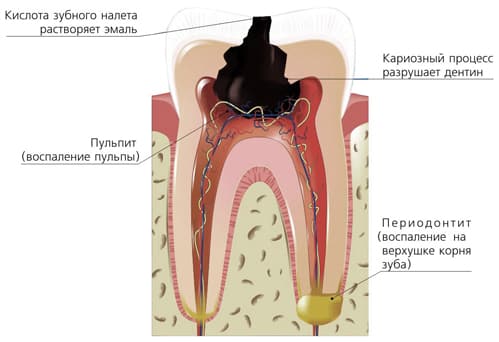 болит зуб болит десна что делать если