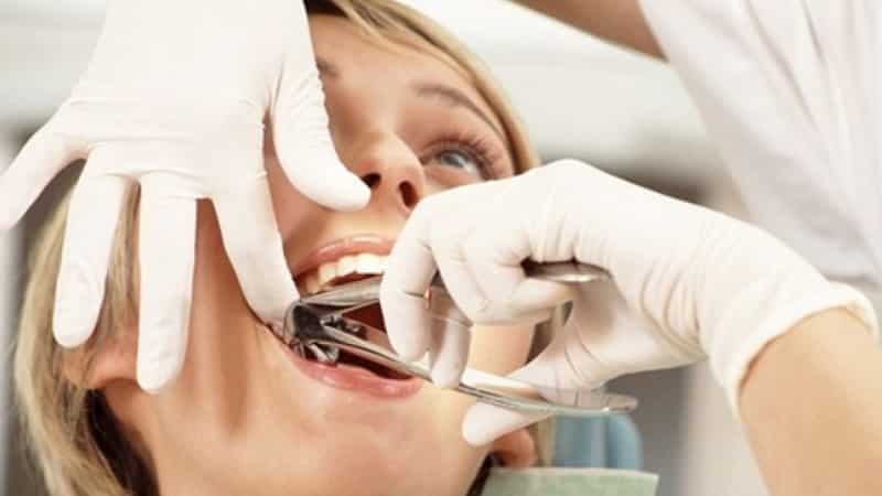 больно ли вырывать зуб