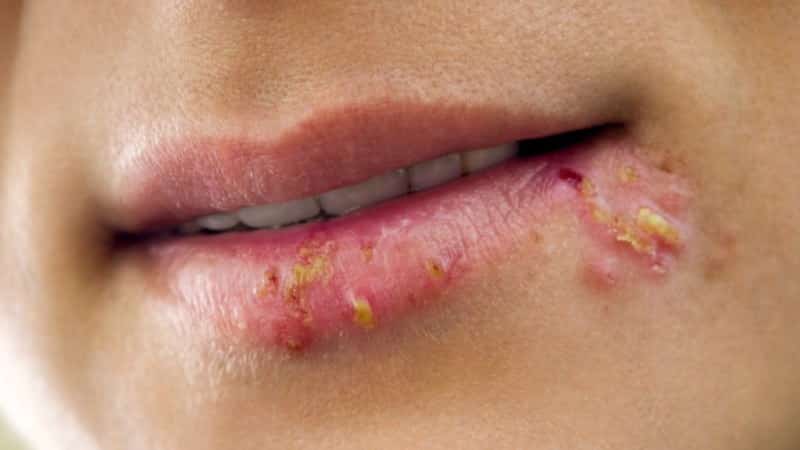 больно вырывать зуб