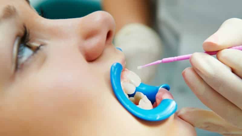 бутылочный кариес как лечить