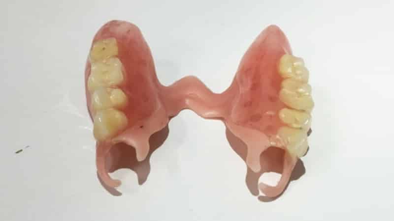 бюгельный протез квадротти