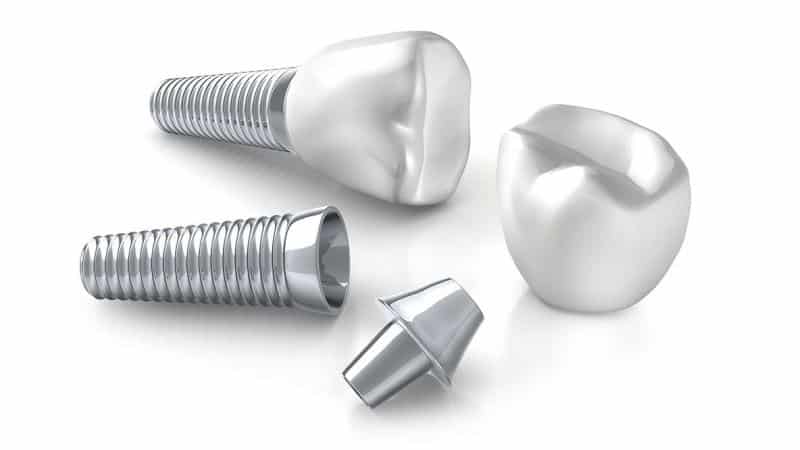 через какое после удаления зуба время можно ставить имплант