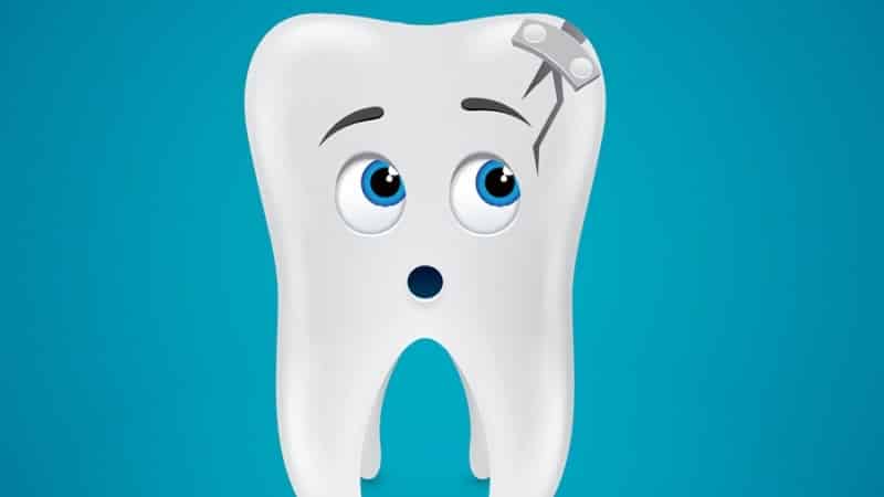 что делать, если треснул зуб.