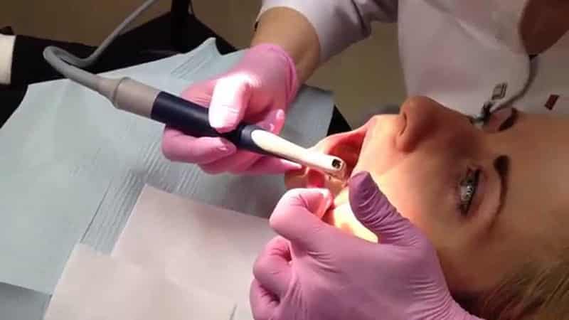 Проблемы с деснами и способы лечения