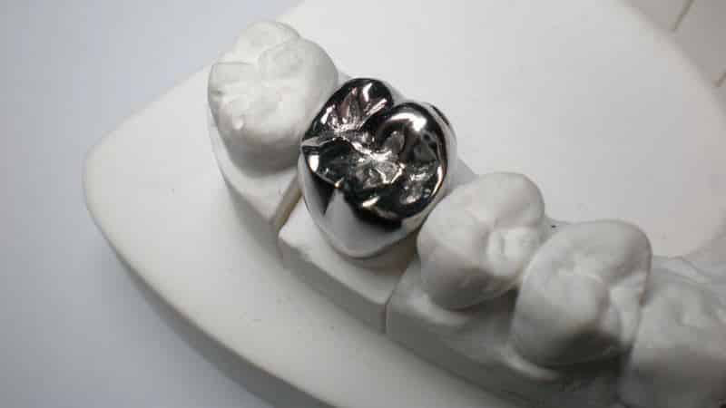 что лучше металлокерамика или безметалловая керамика