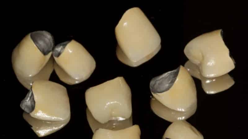 металлокерамика или цирконий