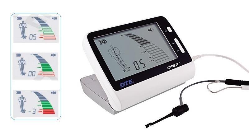 Что такое апекслокатор и как он работает