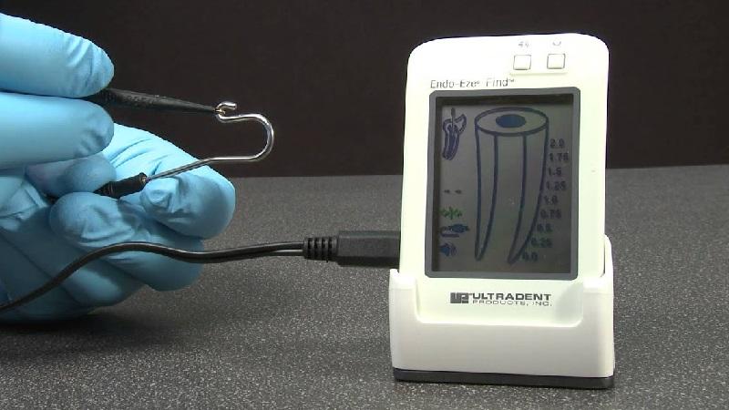 Что такое апекслокатор и как он работает