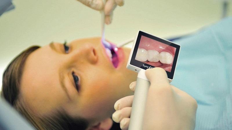 Что такое интраоральная камера