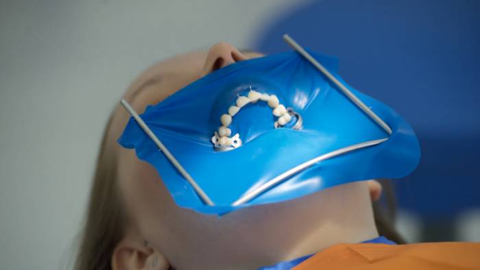 Что такое коффердам в стоматологии