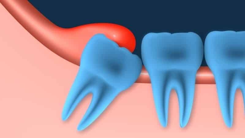 до скольки растут зубы