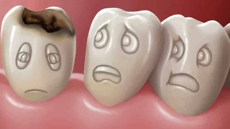 этиология и патогенез кариеса зубов