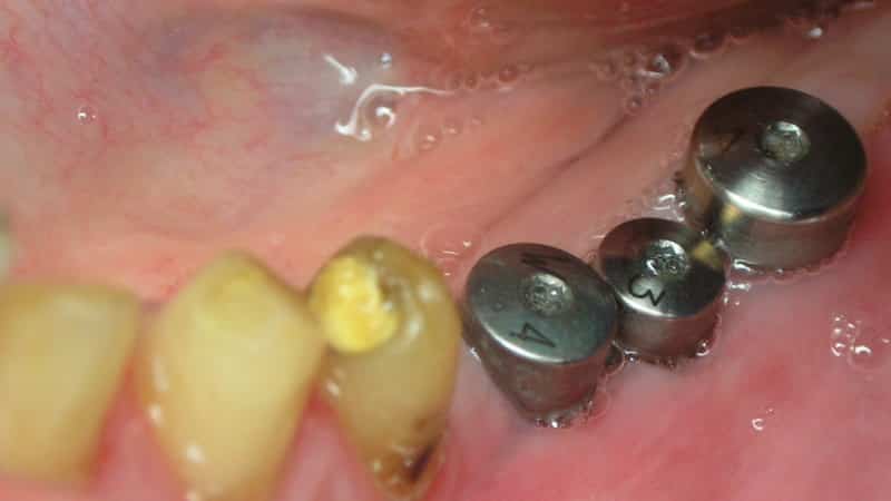 сколько носить