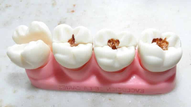 альвеолы во рту это