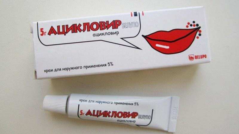 герпесный стоматит у взрослых лечение