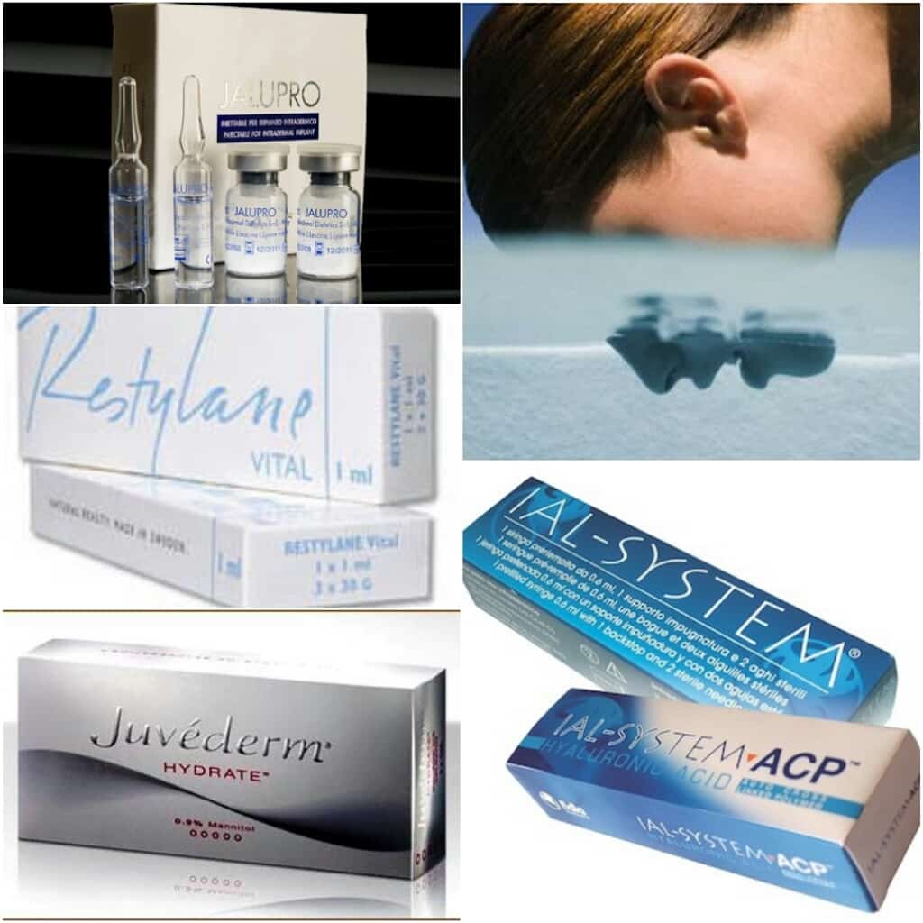 увеличение губ гиалуроновой кислотой фото