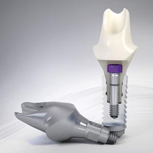 Какие существуют виды имплантатов Nobel Biocare и в чем их преимущества