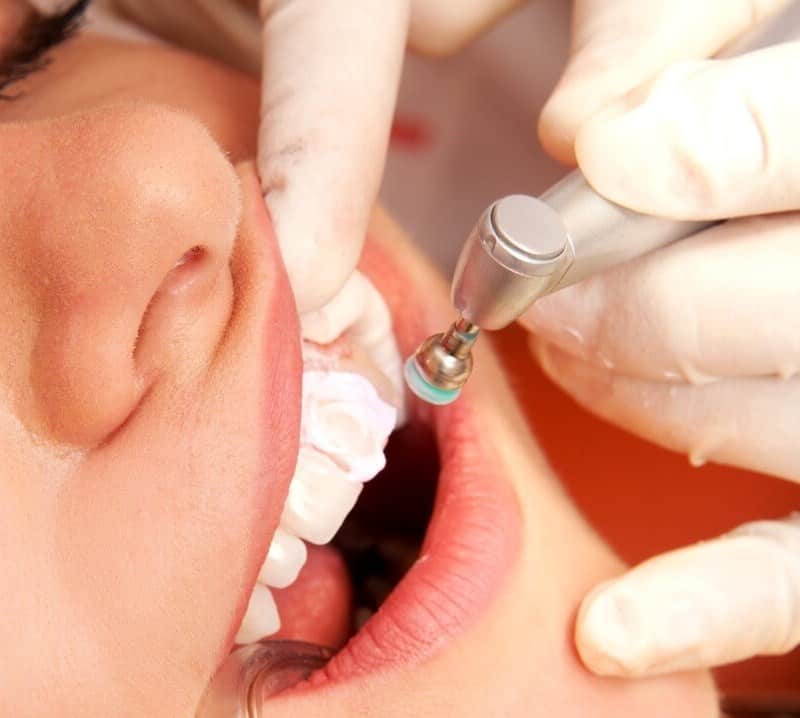 импланты зубов фото до и после