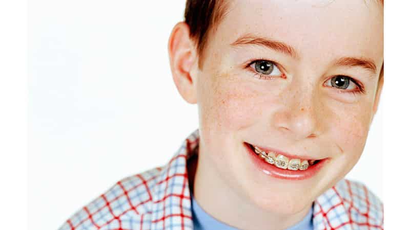 Исправляем прикус у ребенка