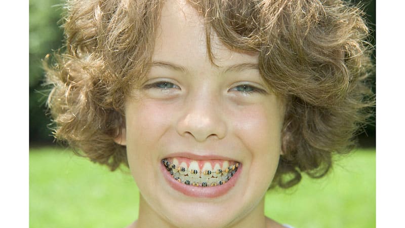 Исправление прикуса фото