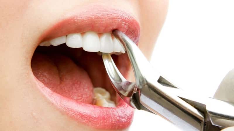 кровь изо рта по утрам лечение