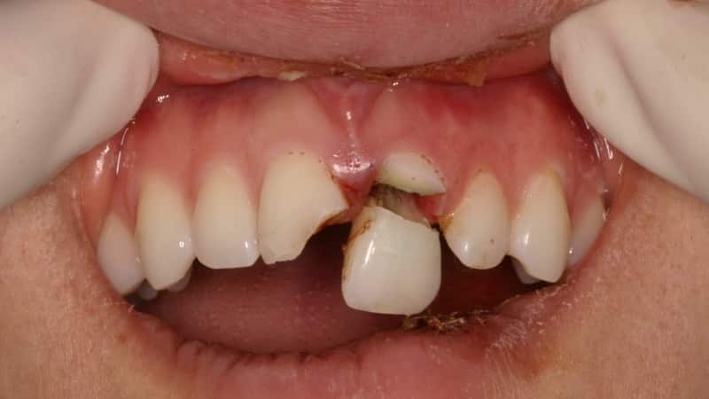 выбили зубы во сне