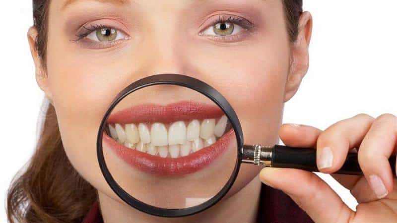 приснилось что крошатся зубы во сне без крови