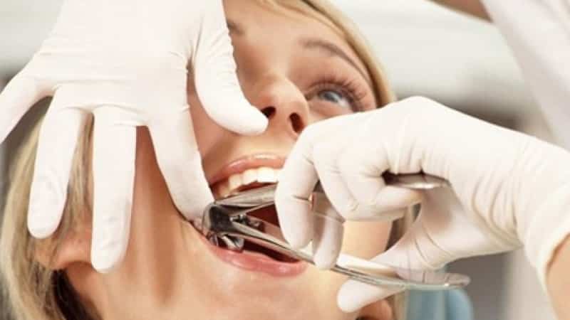 как долго болит десна после удаления коренного зуба