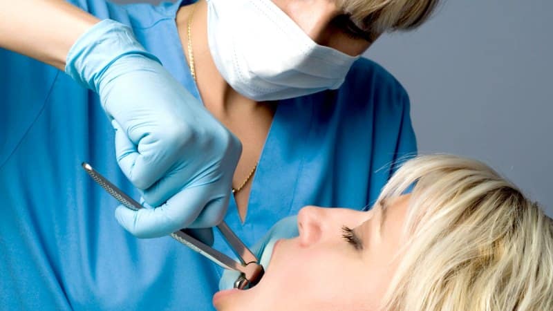 удаление коренного зуба последствия