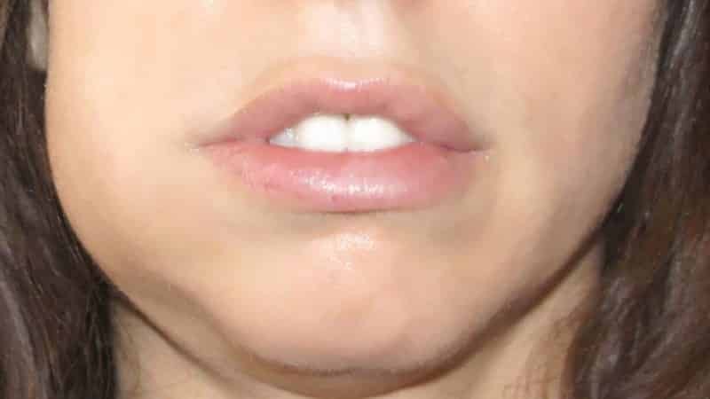 как избавиться от флюса в домашних условиях за день