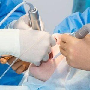 Как лечить экзостоз после удаления зуба