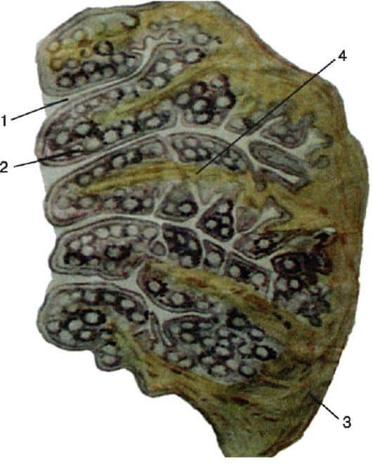 На гландах белые гнойнички что это